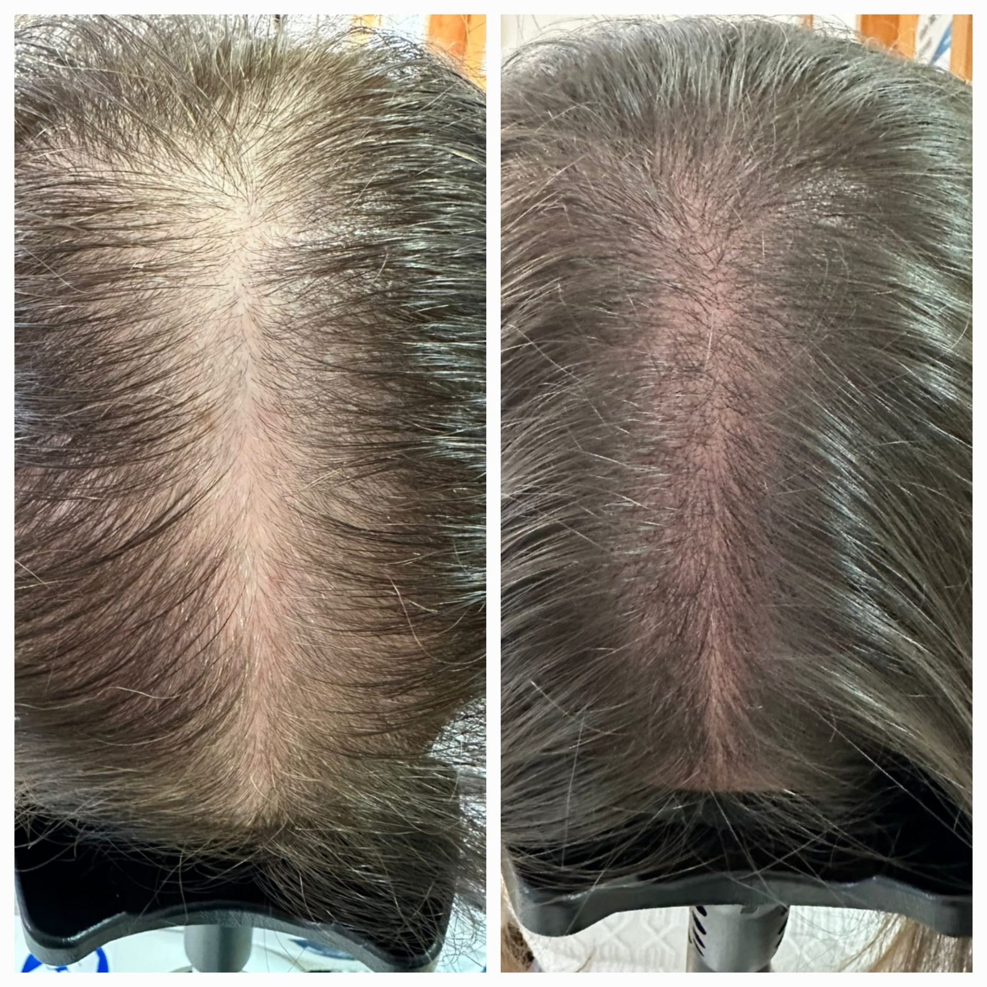 Before and after — Crown Density Support