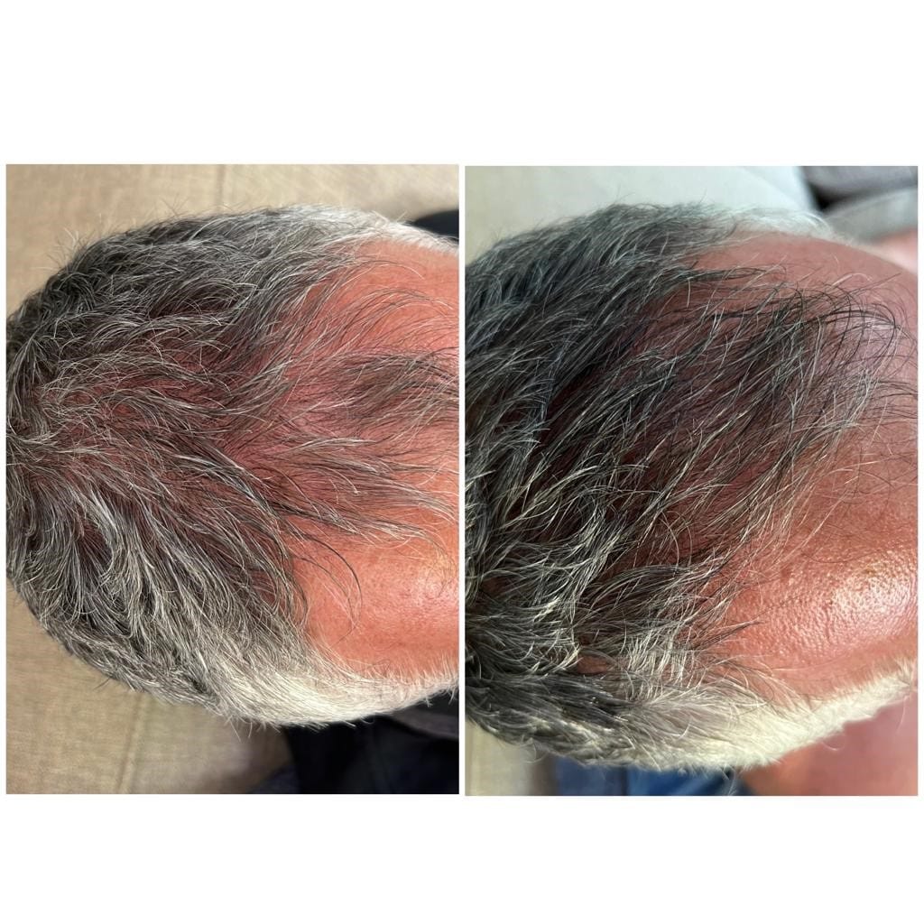 Before and after — Scalp Health Support