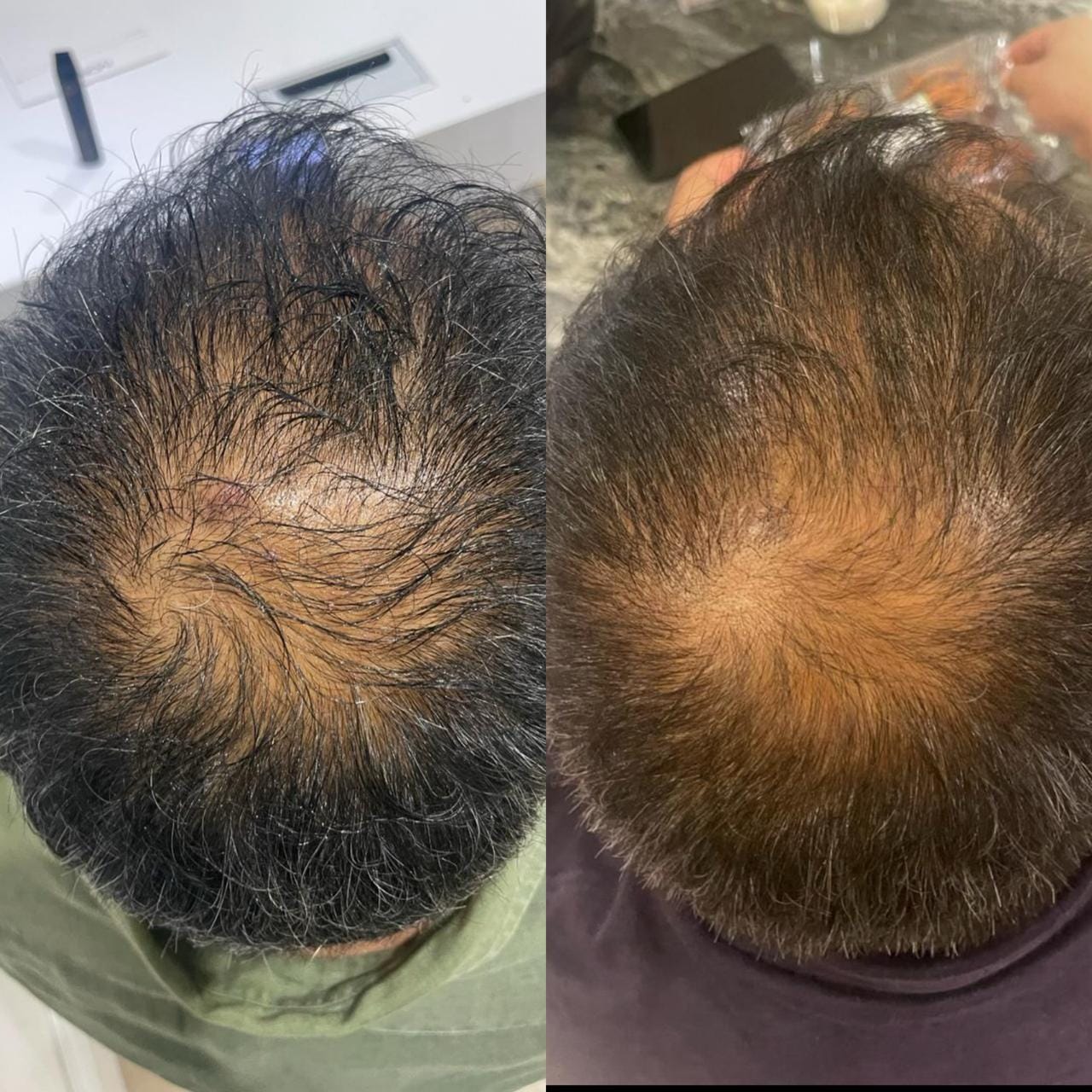 Before and after — Vertex Coverage Support
